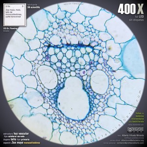 Haz vascular colateral cerrado